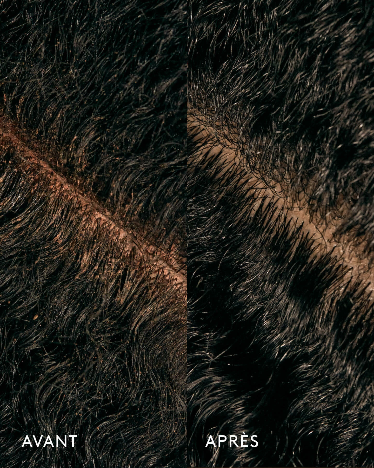 Shampoing Exfoliant Papaya Scalp Scrub – Image 3